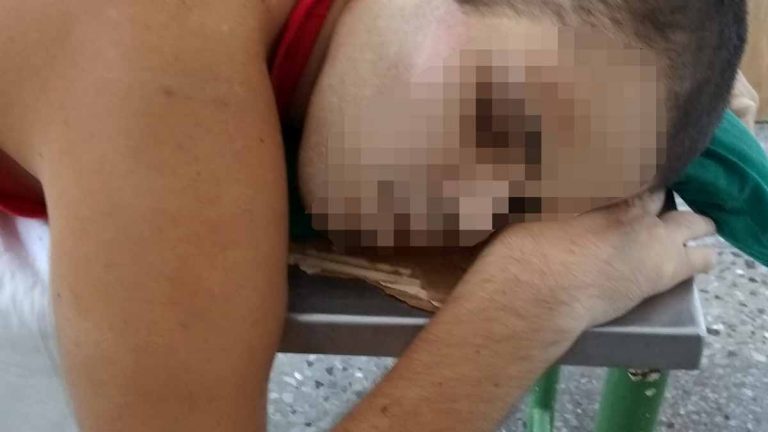 Blind, autistic boy dies in Havana due to ambulance delay